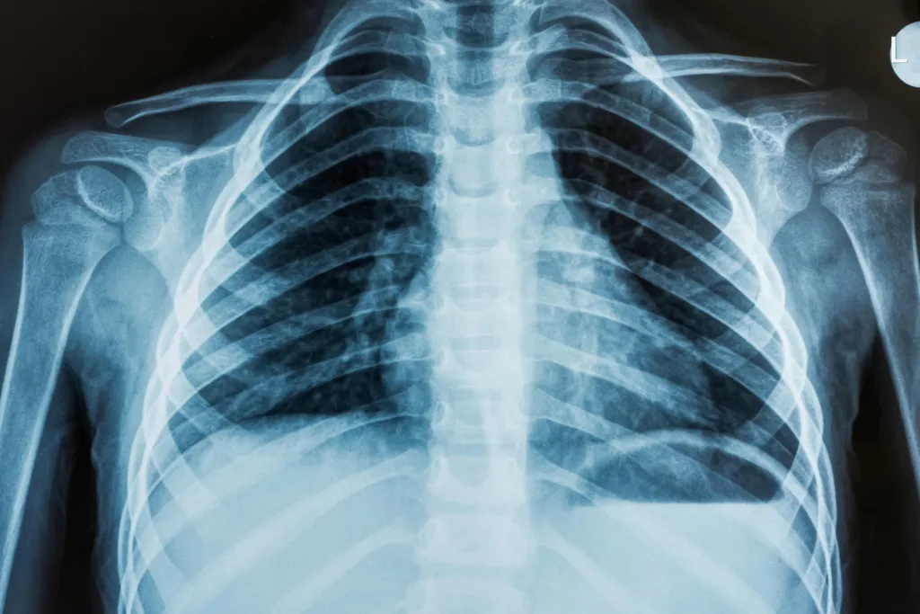Digital X-ray imaging and radiology analysis interface